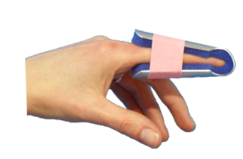 STECCA PER FRATTURA DITA A CAMPANA FARMASPLINT MISURA GRANDE PREFORMATA IN ALLUMINIO MODELLABILE CON IMBOTTITURA IN SPUGNA POLIURETANICA ANTIALLERGICA RADIOTRASPARENTE 15 CM - Farmacia Mastrangelo 